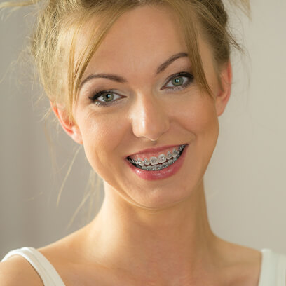 Looking after your fixed brace
