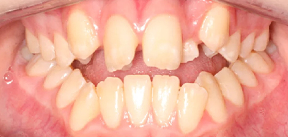 Before & Afters