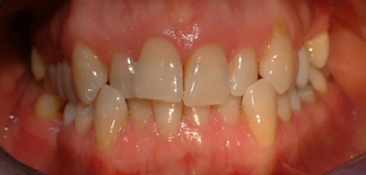 Before & Afters