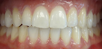 Before & Afters