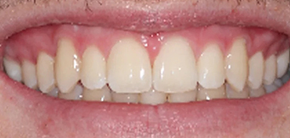 Before & Afters