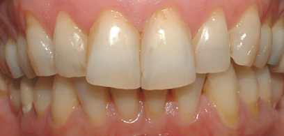 Before & Afters