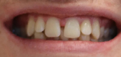 Before & Afters