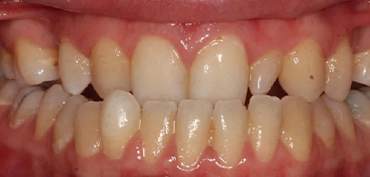 Before & Afters
