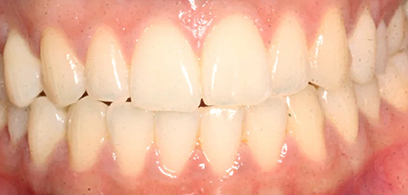 Before & Afters