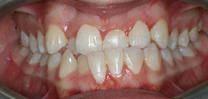 Before & Afters