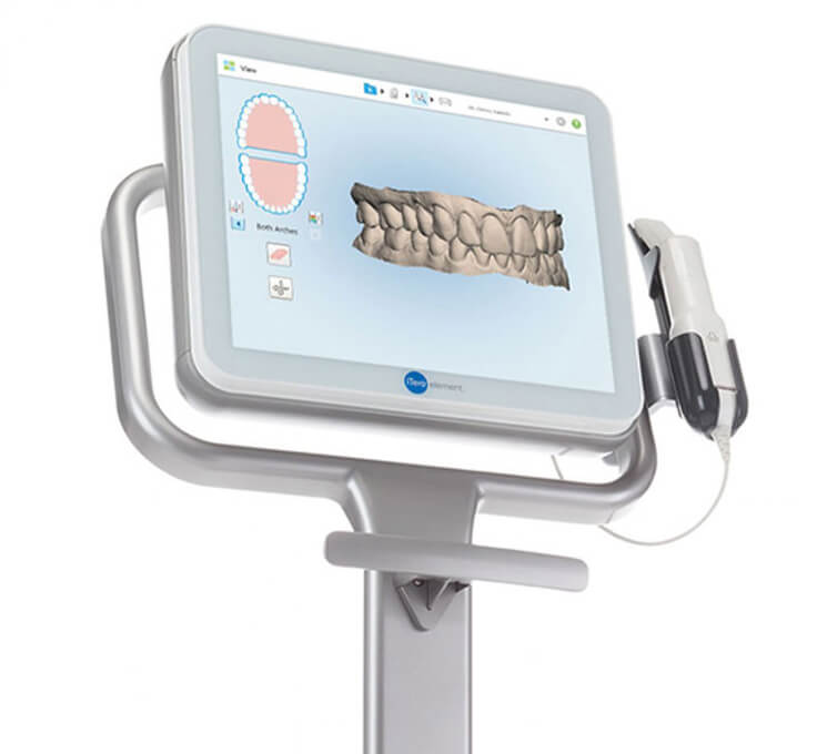 What is the iTero scanner? What is the iTero scanner?