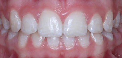 Before & Afters