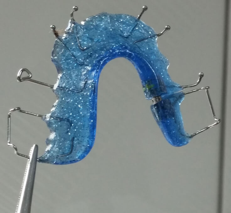 Fixed retainers Fixed retainers