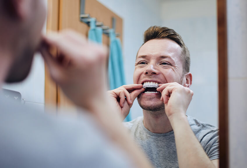 Brace After Care: Retainers Brace After Care: Retainers