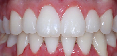 Before & Afters