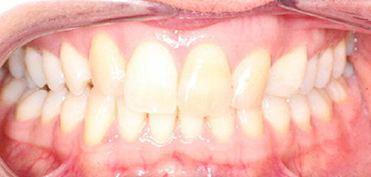 Before & Afters