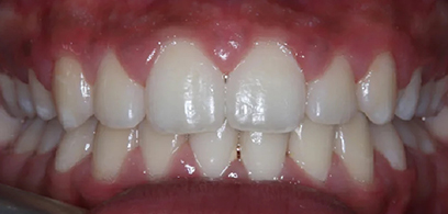 Before & Afters