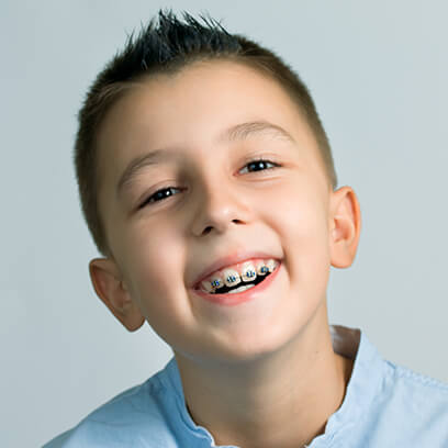 NHS braces