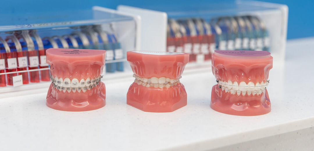 Invisalign or Tooth Coloured Fixed Braces? Which is best for you? Invisalign or Tooth Coloured Fixed Braces? Which is best for you?