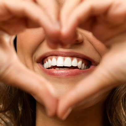 Smile gallery