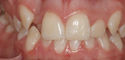 Before & Afters