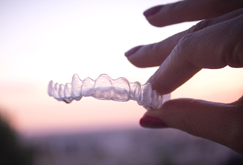 Retainers: the secret to a lasting smile Retainers: the secret to a lasting smile