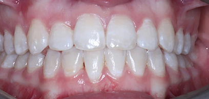 Before & Afters
