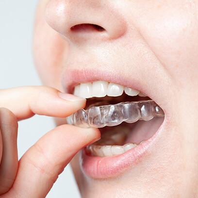 Retainers