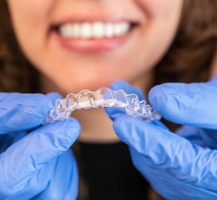 Removable retainers Removable retainers