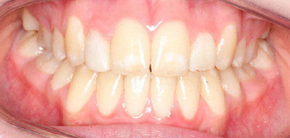 Before & Afters
