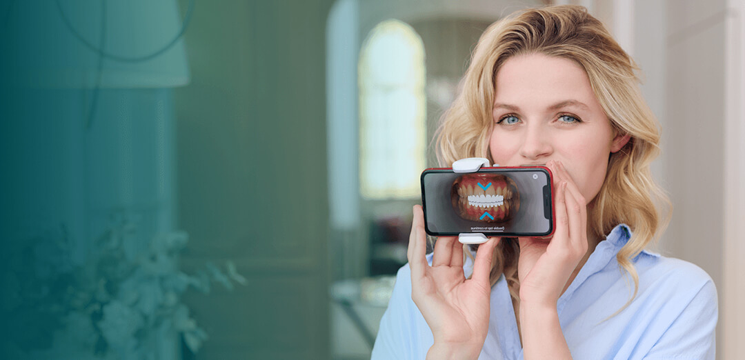 Dental Monitoring Dental Monitoring